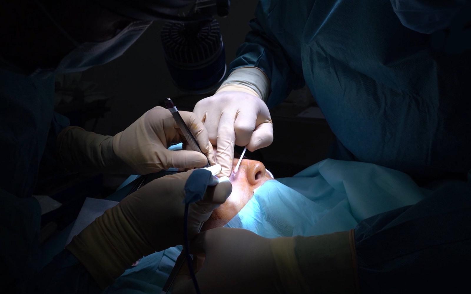 Blefaroplastia o cirugía de párpados
